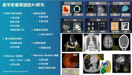 IBM Watson Health:AI医疗坚定的“长跑者”